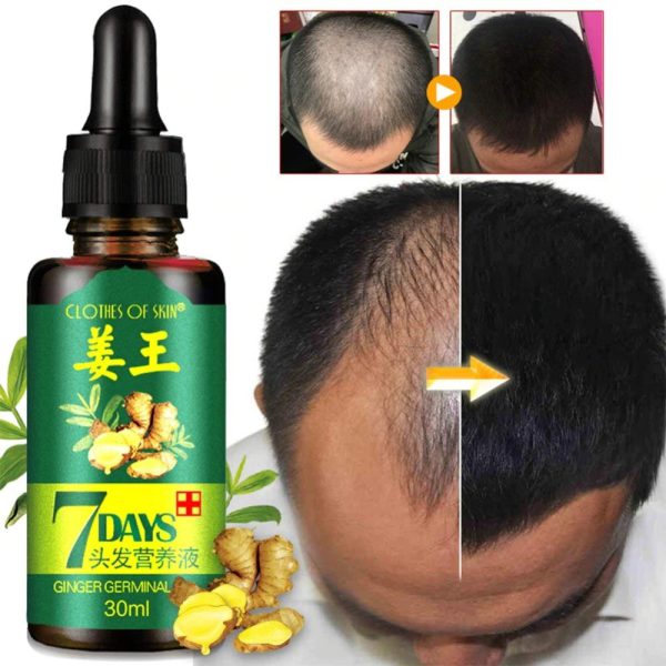 7 Day Ginger Germinal Oil Hair Nutrient Solution Hair Growth Essence Liquid Fast Natural Hair Loss Treatment Hair Care (30ml)