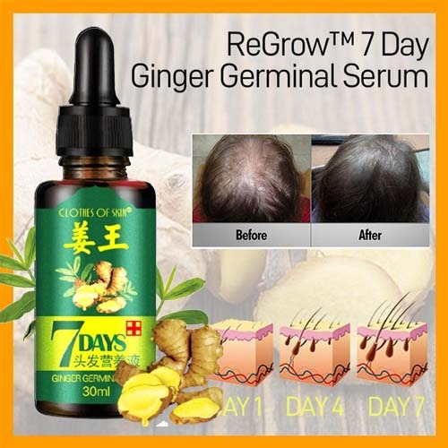 7 Day Ginger Germinal Oil Hair Nutrient Solution Hair Growth Essence Liquid Fast Natural Hair Loss Treatment Hair Care (30ml)