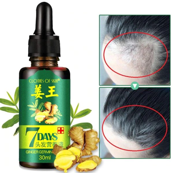 7 Day Ginger Germinal Oil Hair Nutrient Solution Hair Growth Essence Liquid Fast Natural Hair Loss Treatment Hair Care (30ml)